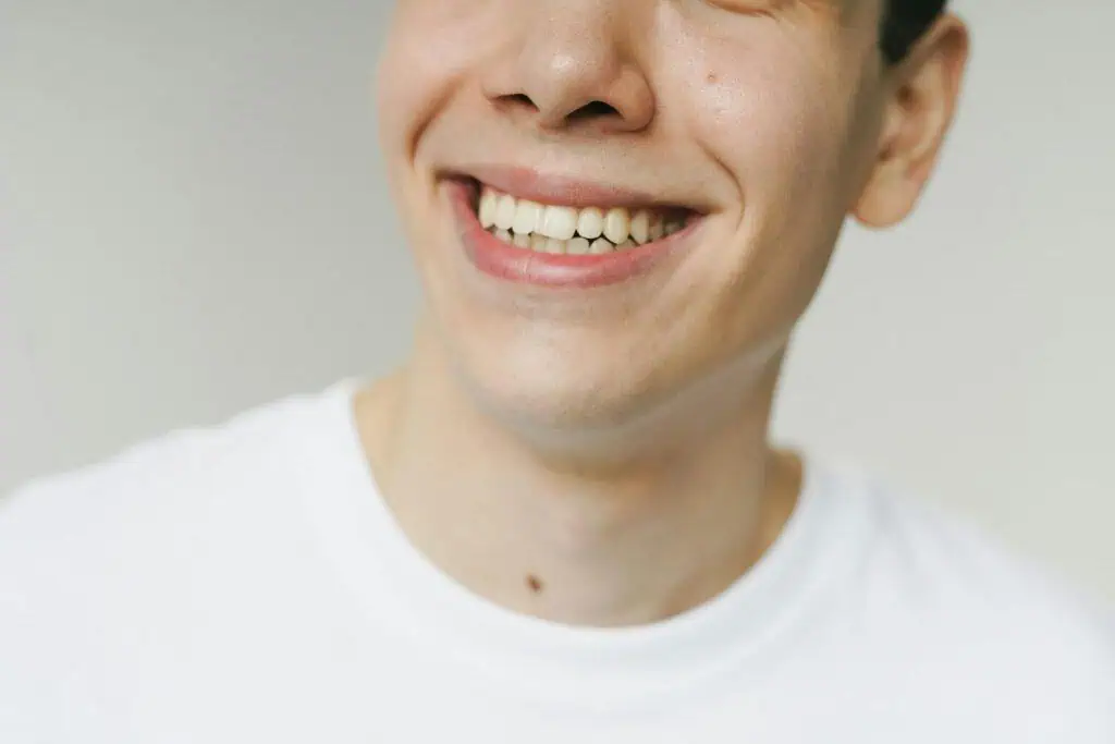 Close-up of a smiling person in a white shirt, symbolizing relief and recovery from TMJ disorder.